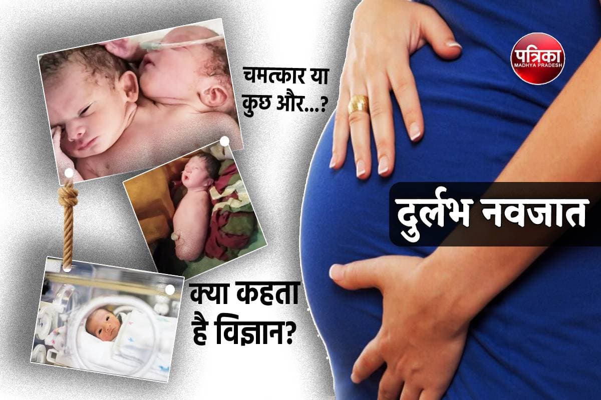 Bizarre baby born in mp facts reason