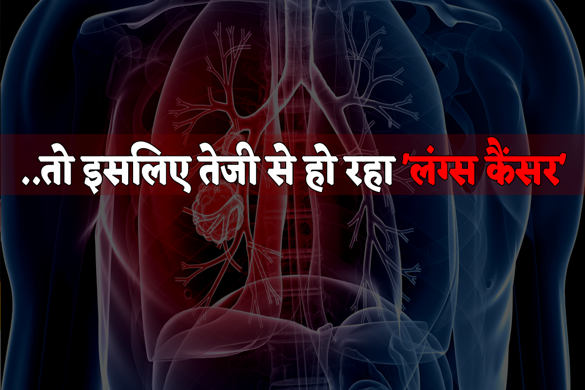 Lungs Cancer Cases